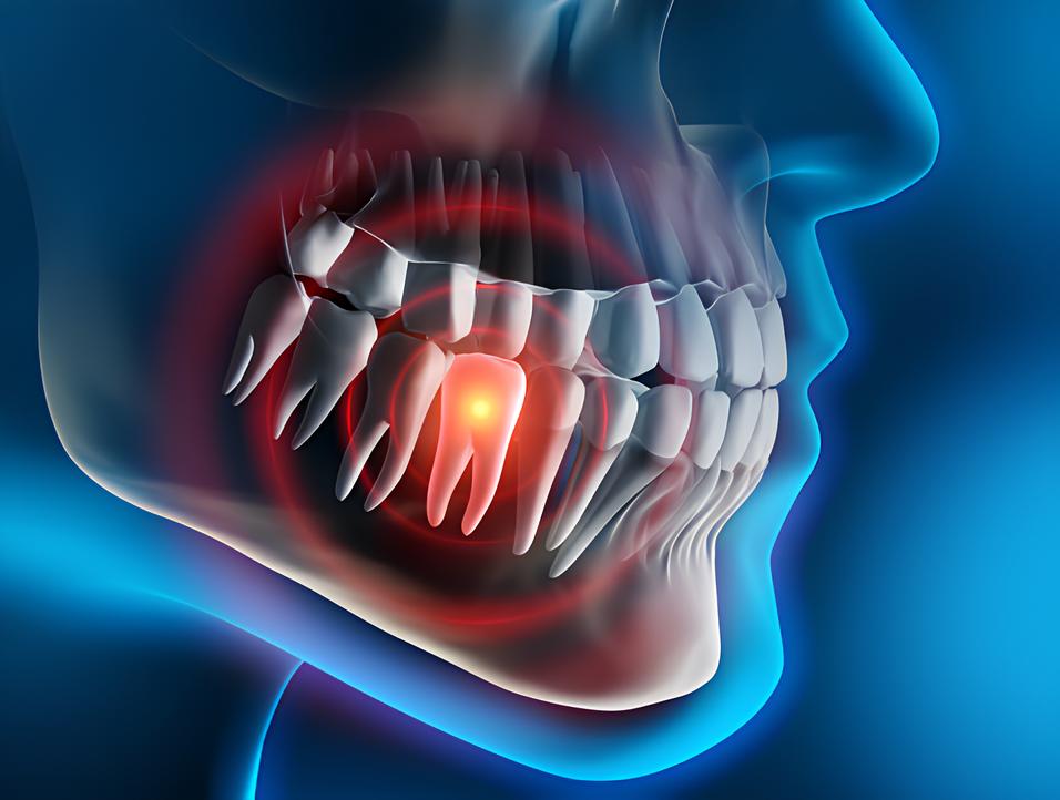Teeth image - Emergency dentist Rotherham